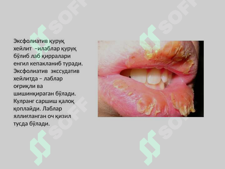 sellerImage
