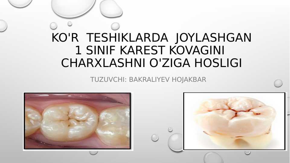 ko’r teshiklarda  joylashgan 1-sinif karest kovagini  charxlashni o'ziga hosligi