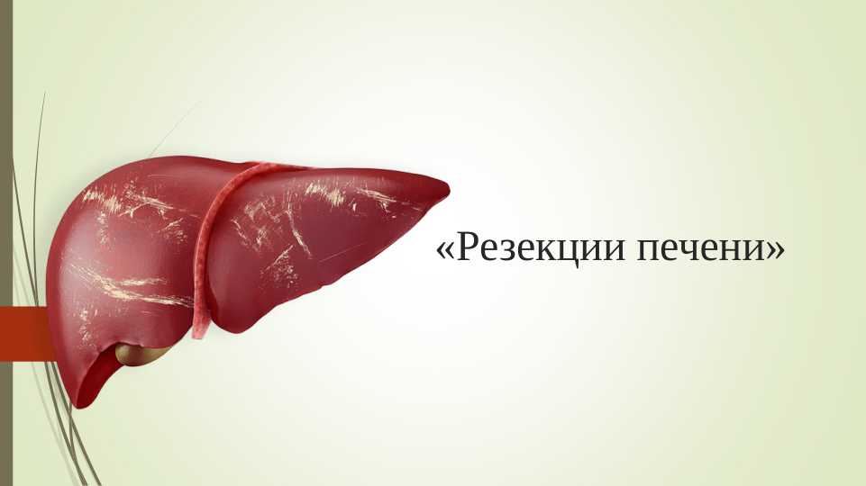 Резекции печени