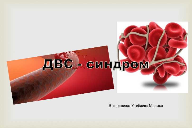 двс синдроми