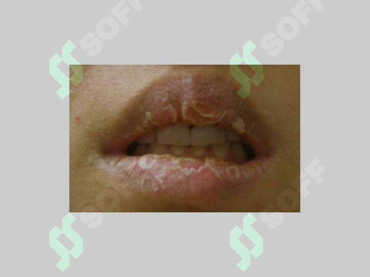 sellerImage