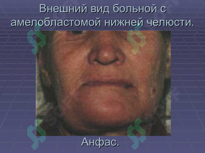 sellerImage