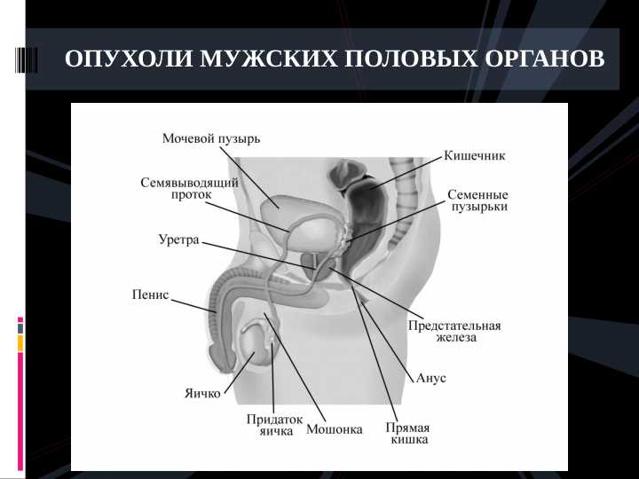 ОПУХОЛИ МУЖСКИХ ПОЛОВЫХ ОРГАНОВ