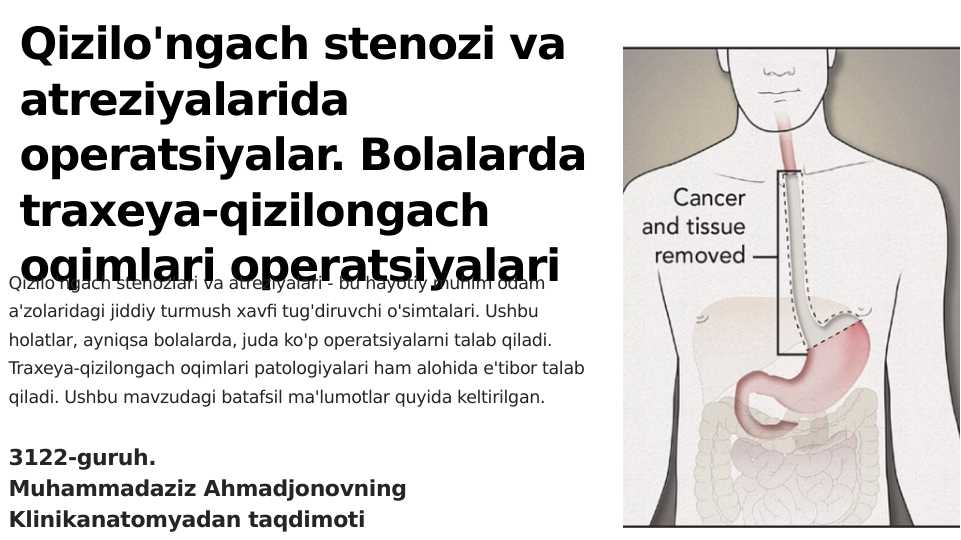 Qizilo'ngach stenozi va atreziyalarida operatsiyalar. Bolalarda traxeya-qizilongach oqimlari operatsiyalari