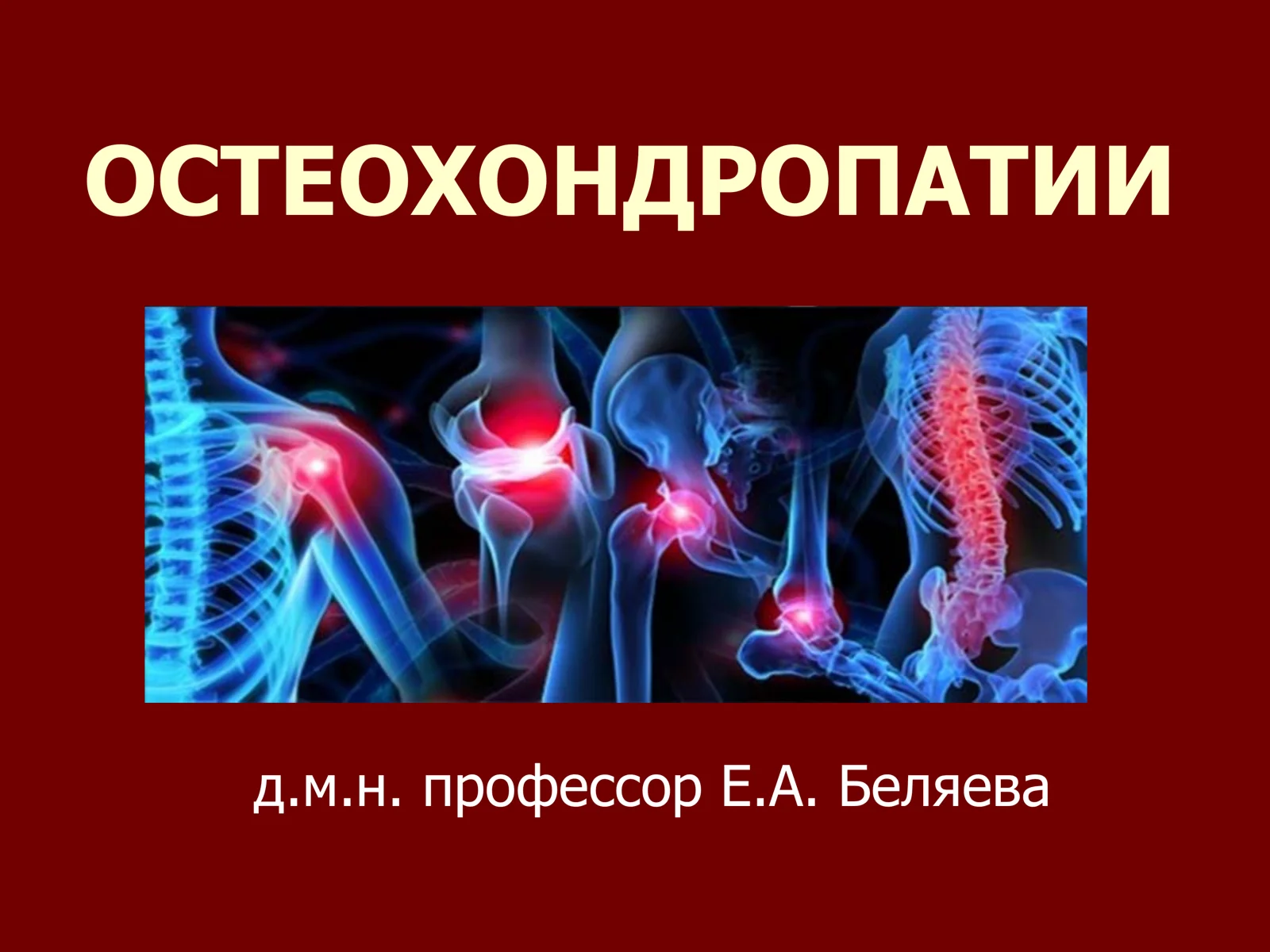 ОСТЕОХОНДРОПАТИИ