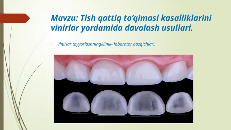 stomatologiyada vinirlar bilan ishlash