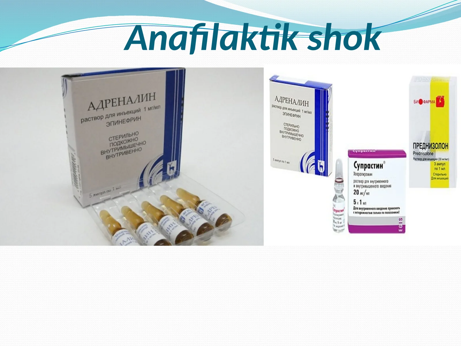 Anafilaktik shok