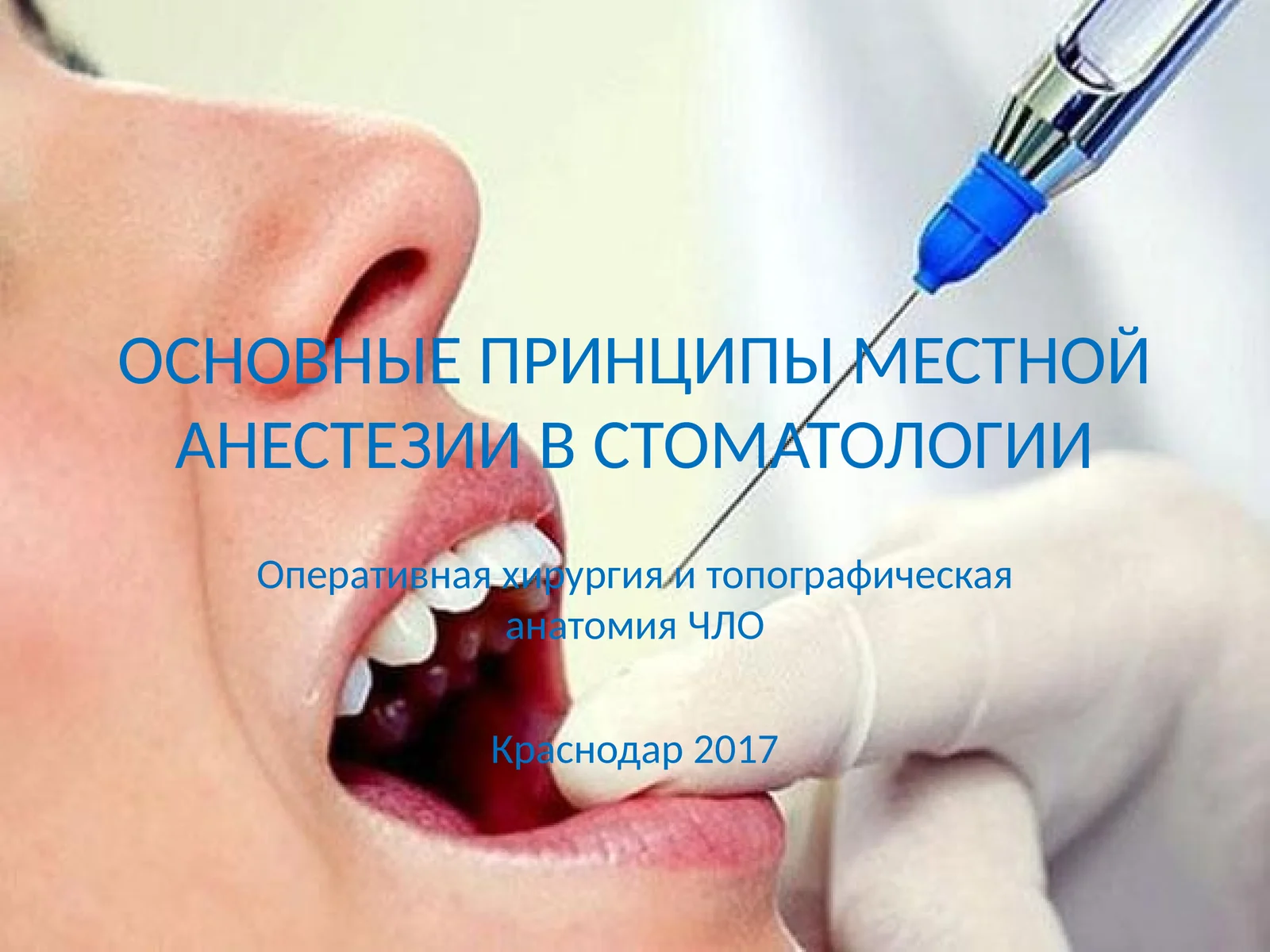 ОСНОВНЫЕ ПРИНЦИПЫ МЕСТНОЙ АНЕСТЕЗИИ В СТОМАТОЛОГИИ