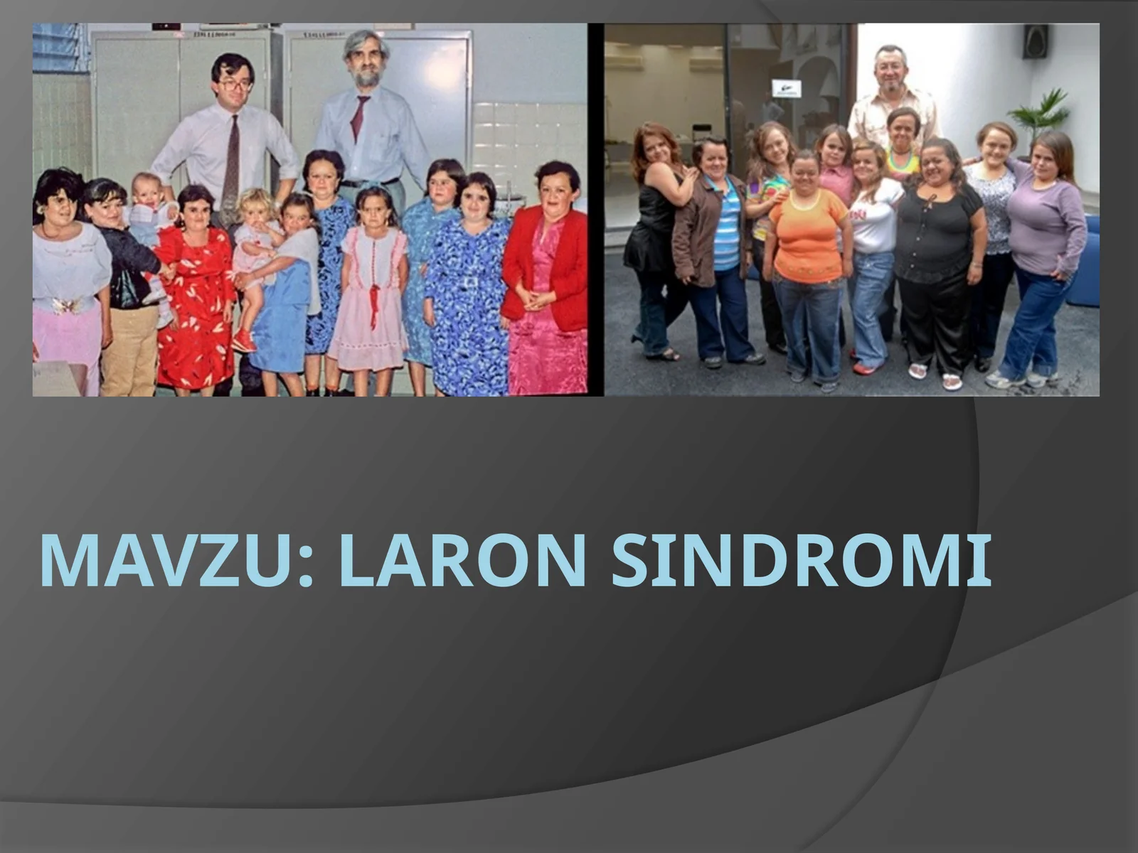 Laron Sindromi