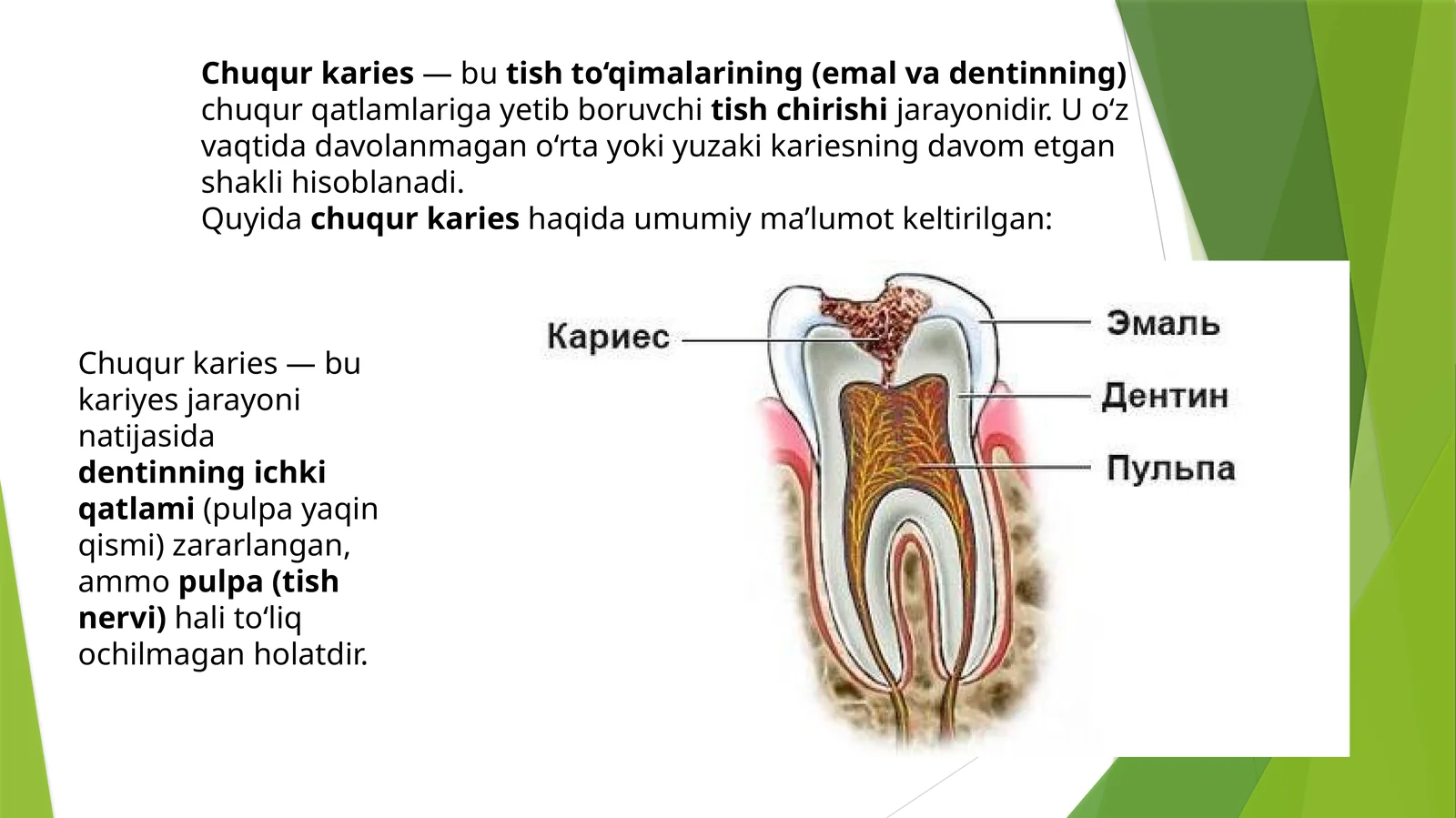 Chuqurkaries