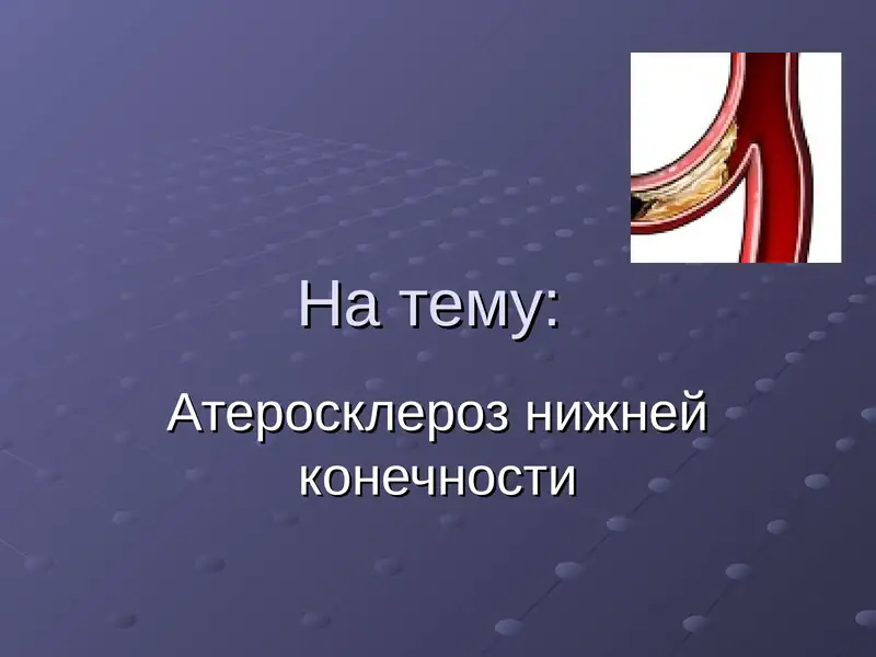 Атеросклероз нижней конечности