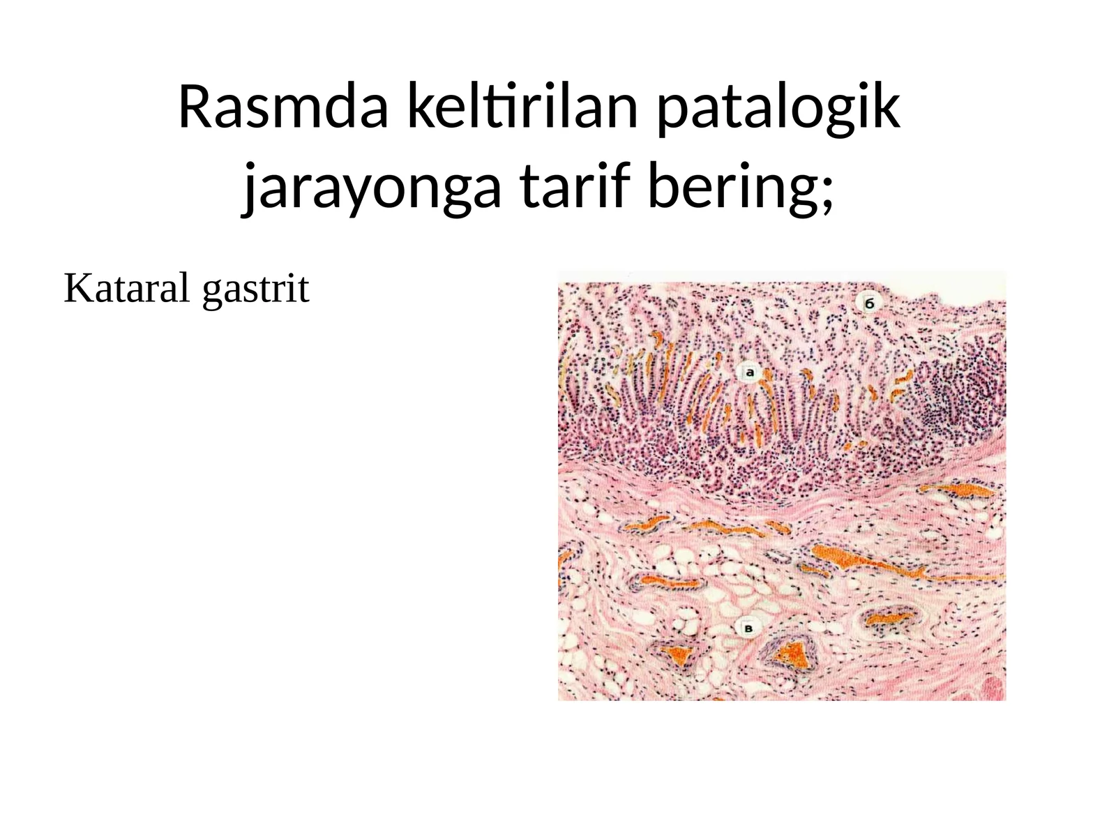 Kataralgastrit