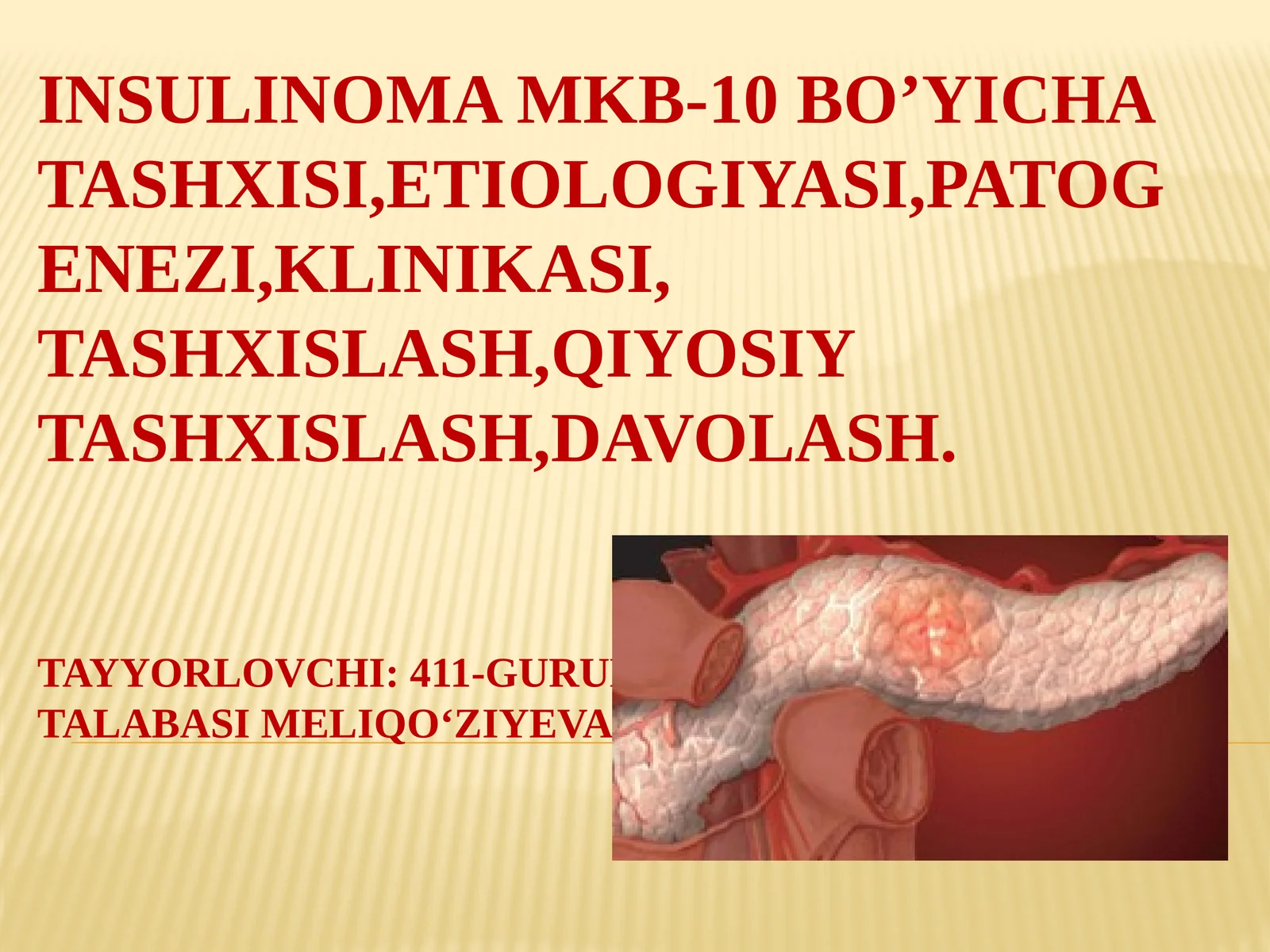 Insulinoma