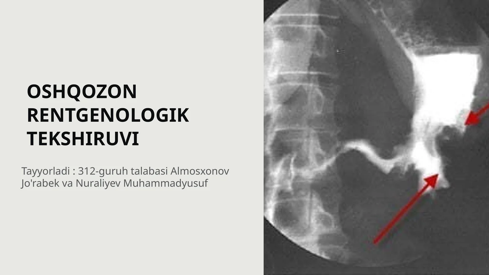 OSHQOZON RENTGENOLOGIK TEKSHIRUVI