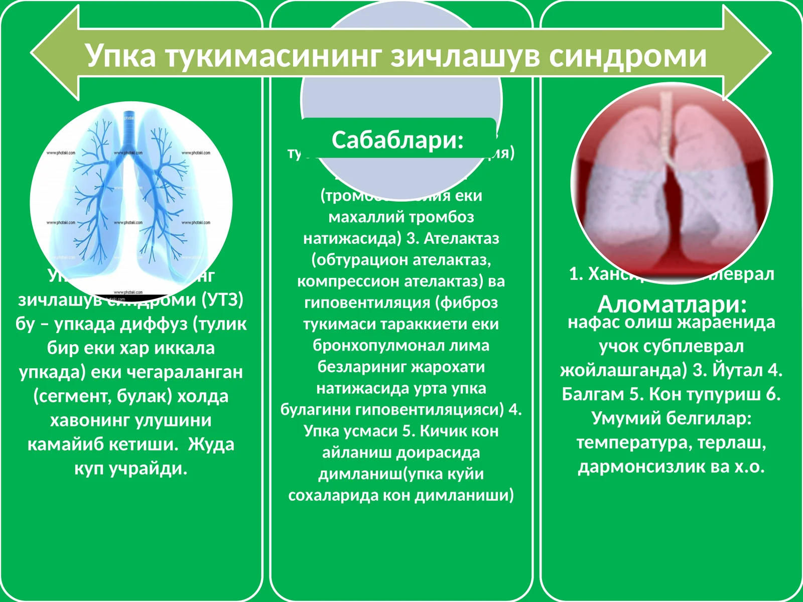Упка тукимасининг зичлашув синдроми