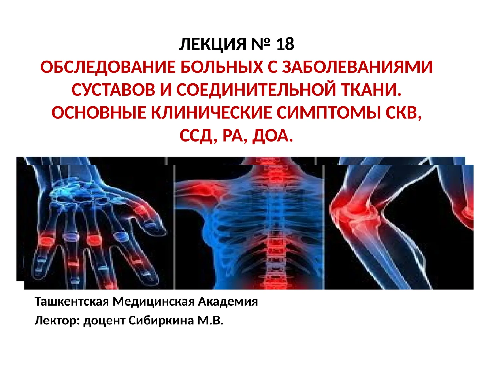 ЛЕКЦИЯ № 18ОБСЛЕДОВАНИЕ БОЛЬНЫХ С ЗАБОЛЕВАНИЯМИ СУСТАВОВ И СОЕДИНИТЕЛЬНОЙ ТКАНИ. ОСНОВНЫЕ КЛИНИЧЕСКИЕ СИМПТОМЫ СКВ, ССД, РА, ДОА