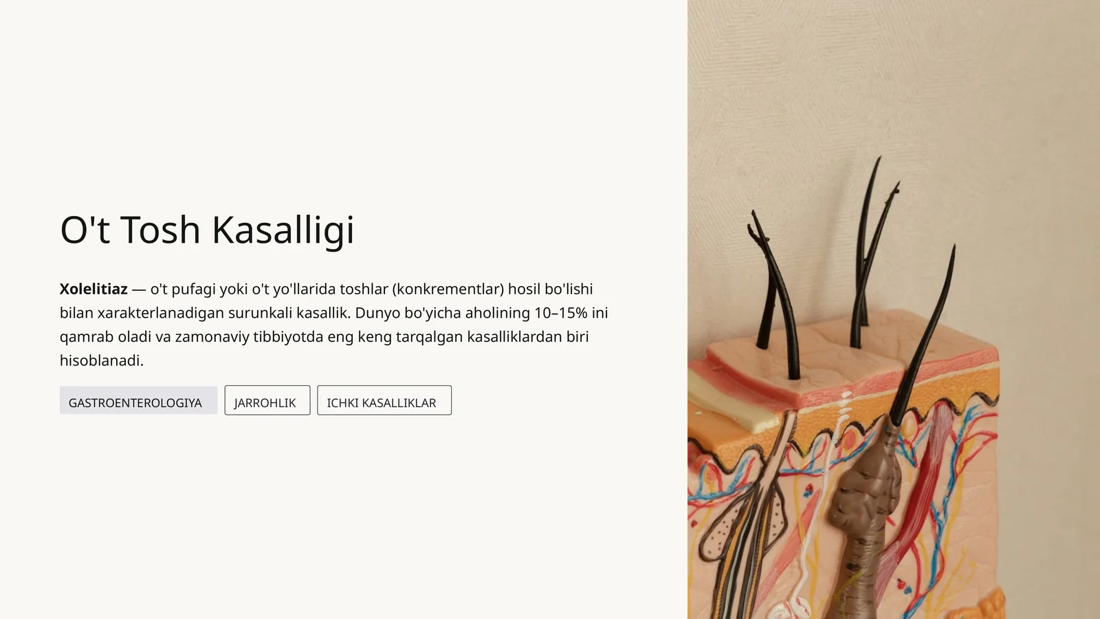 O't Tosh Kasalligi