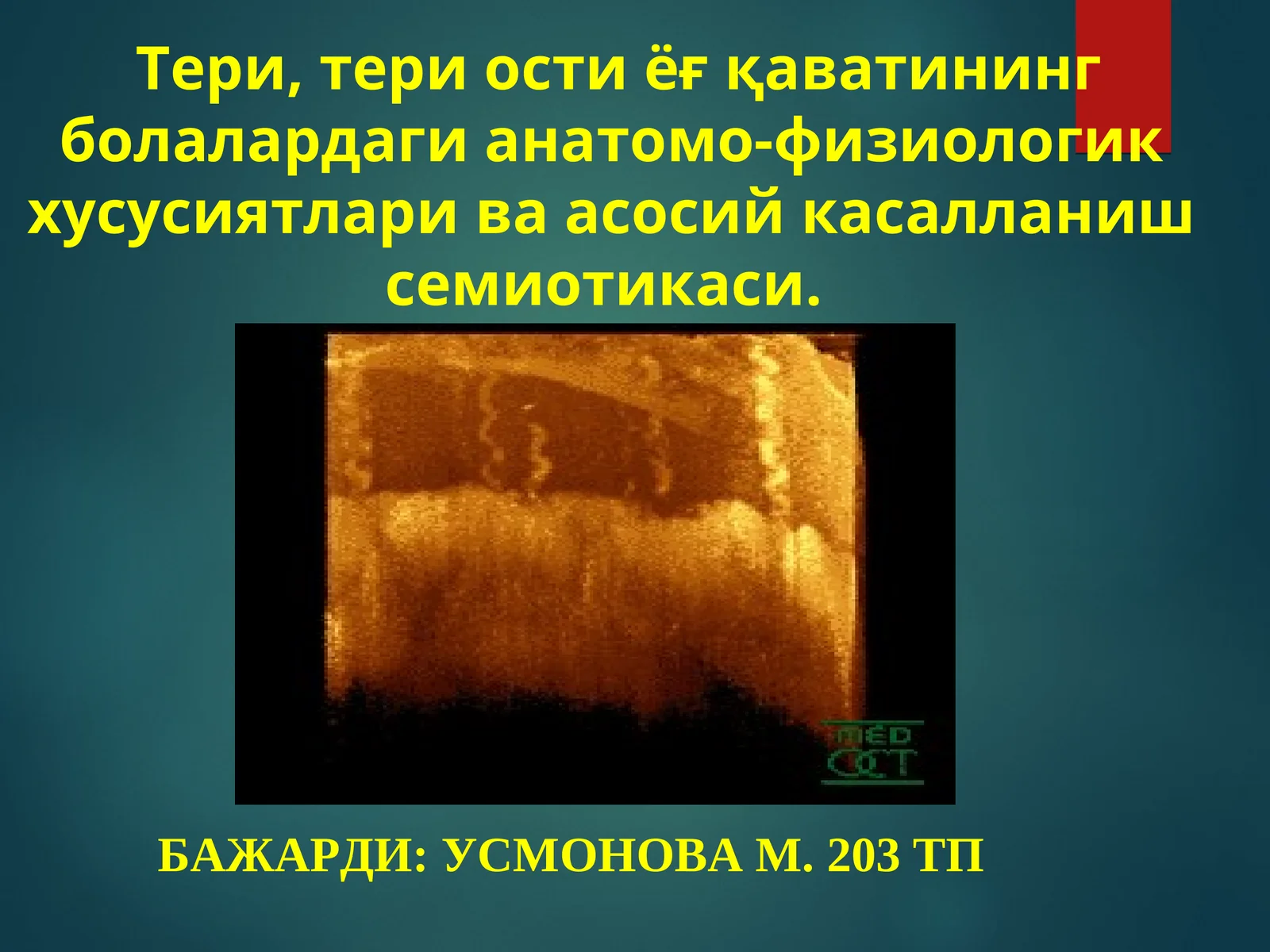 Тери, тери ости ёғқаватининг болалардаги анатомо-физиологик хусусиятларива асосий касалланиш семиотикаси