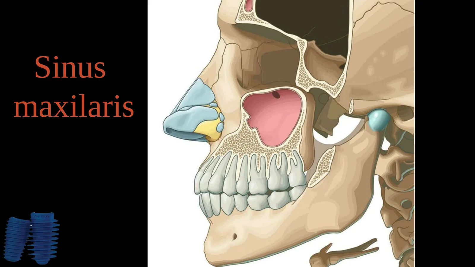 Sinus Lifting