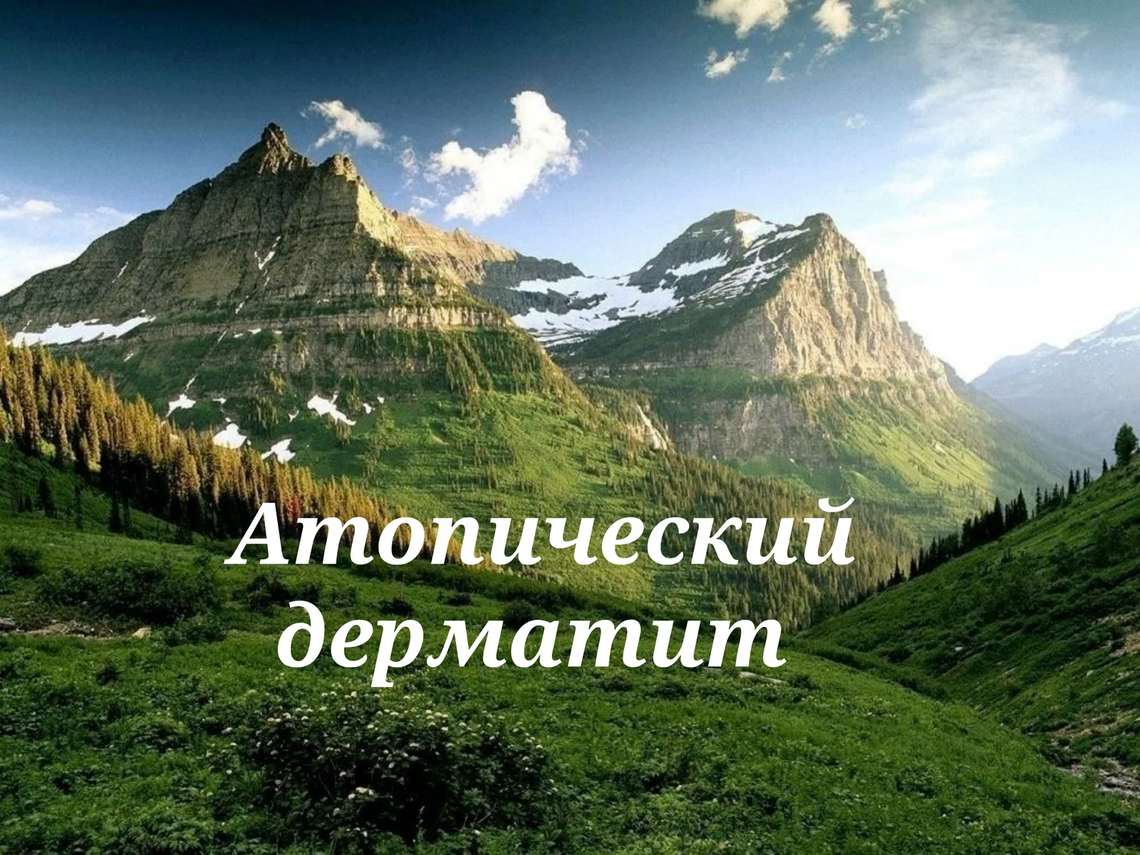 атопик дерматит