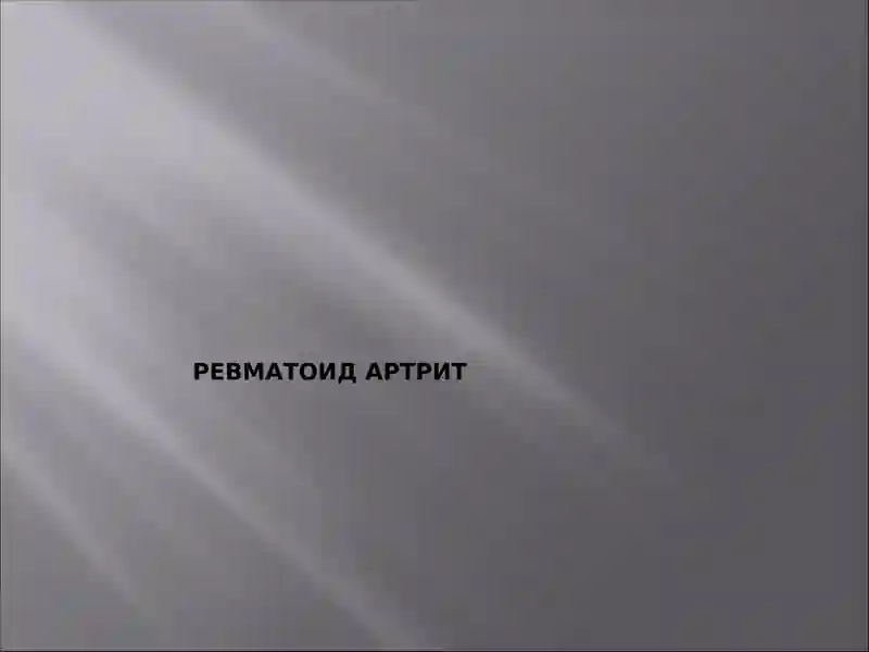 Ревматоид артрит