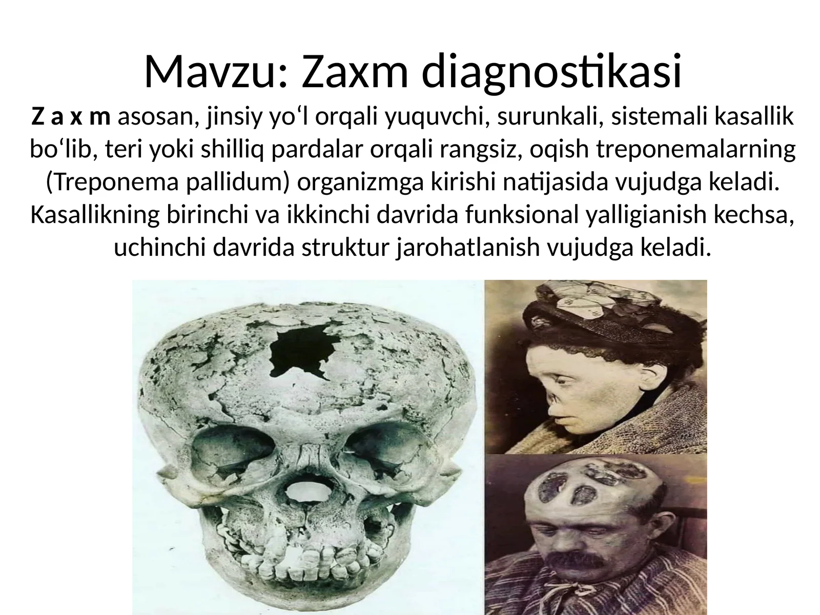 Zaxm diagnostikasi