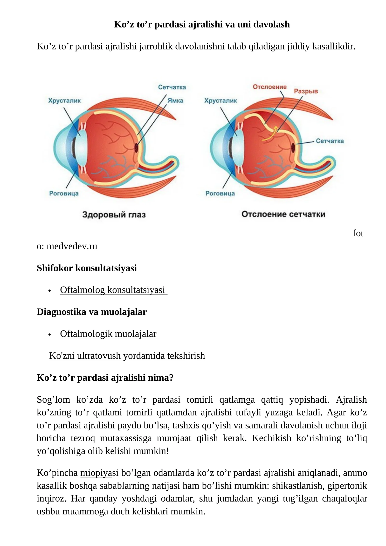 Ko’z to’r pardasi ajralishi va uni davolash