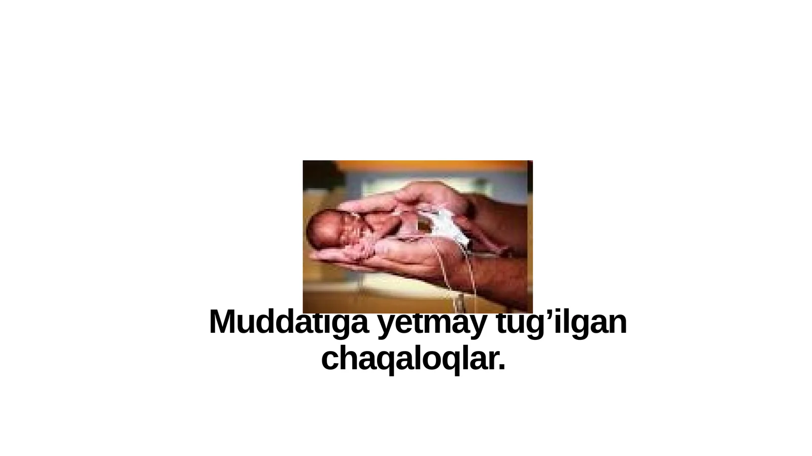 Muddatigayetmaytug’ilganchaqaloqlar