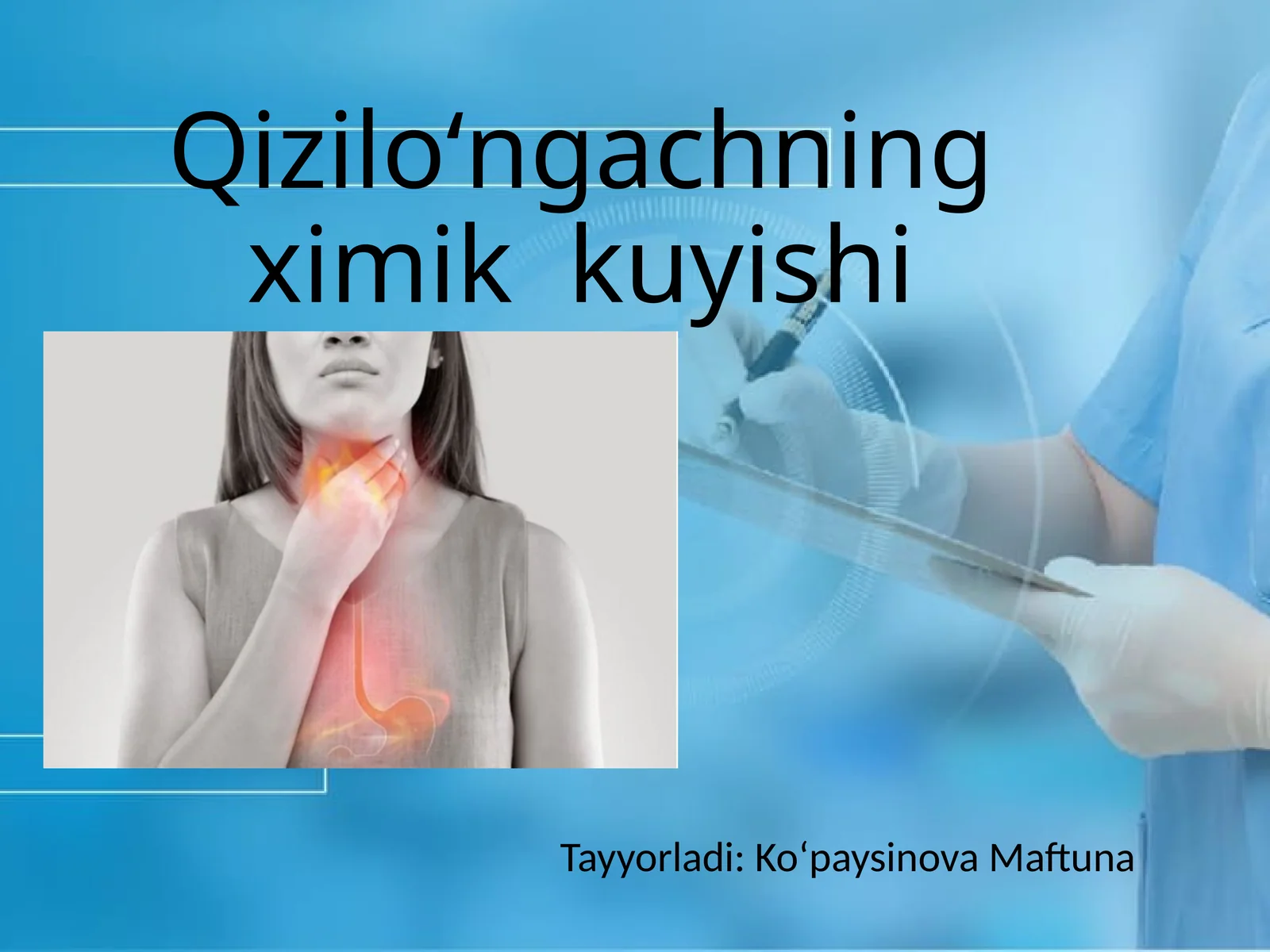 Qiziloʻngachning ximik kuyishi(xirurgiya)