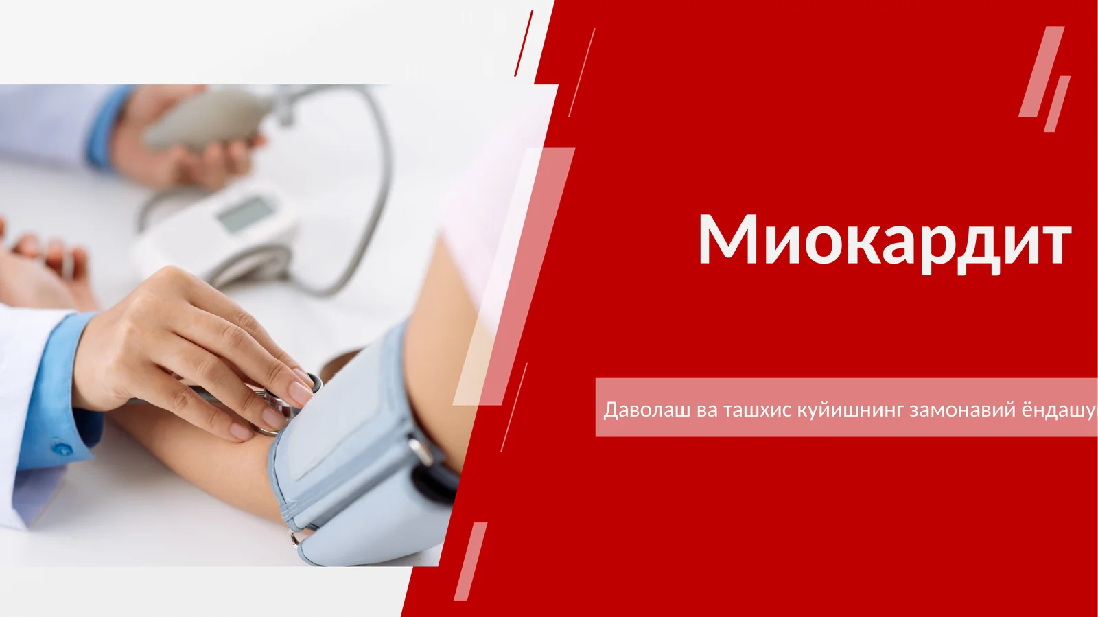 миокардит 2026