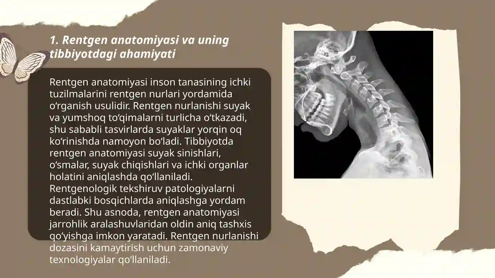 Tishlarning rentgen anatomiyasi