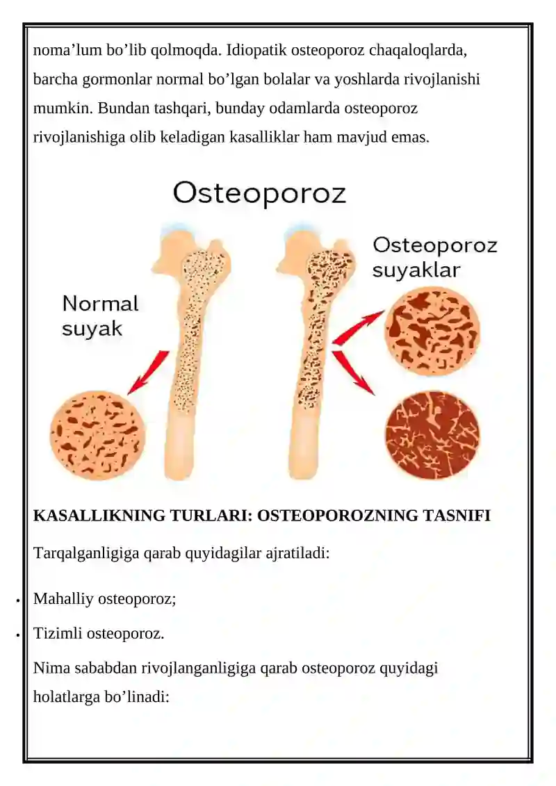 OSTEOPOROZ VA SUYAK KASALLIKLARI