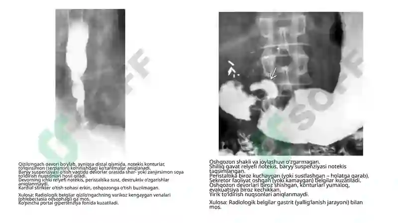 Rentgen tahlillari yig'indisi tibbiy radiologiya