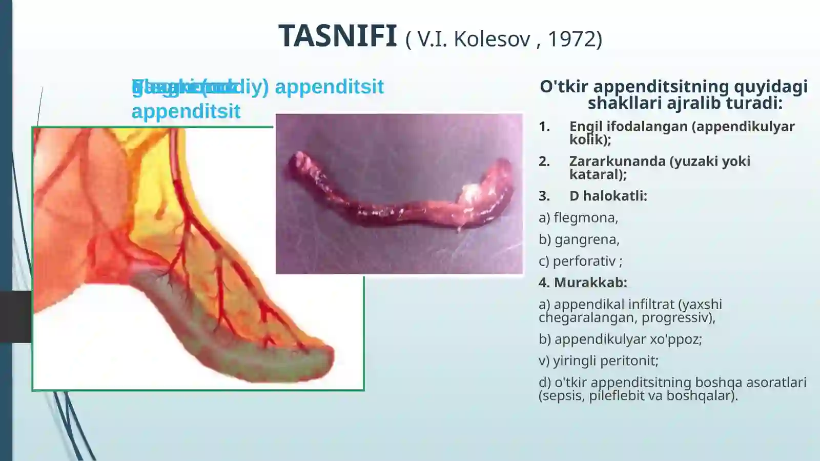 o‘tkir apenditsit