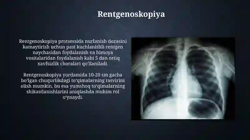 Rentgen nurlanishi, Rentgen nurlarining tibbiyotdagi ahamiyati