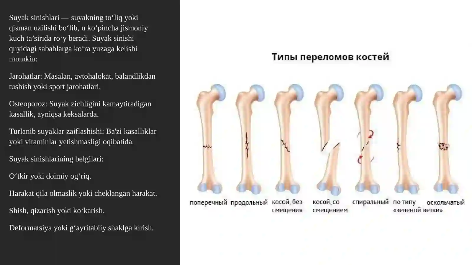 Suyak rivojlanishining buzilishlari. Sinishlar. Osteonekrozlar