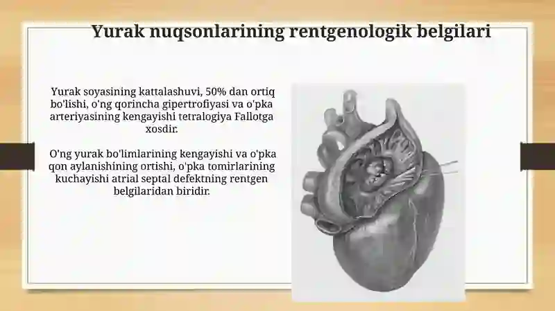 Yurak va Qon Tomirlarining Rentgen Anatomiyasi