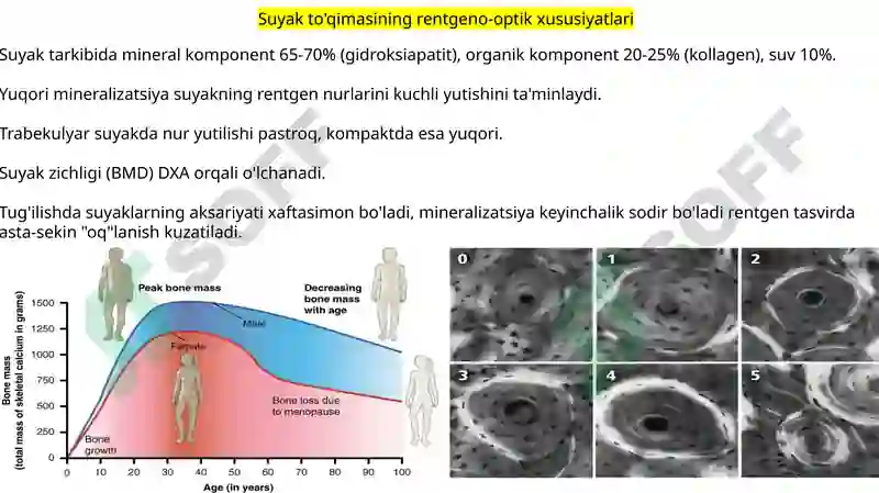 Rentgen_nurlarini_o'rganish_tarixi,_suyak_va_bo'g'imlar_rivojlanishini