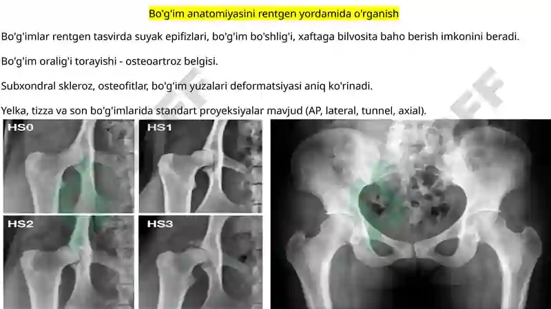 Rentgen_nurlarini_o'rganish_tarixi,_suyak_va_bo'g'imlar_rivojlanishini