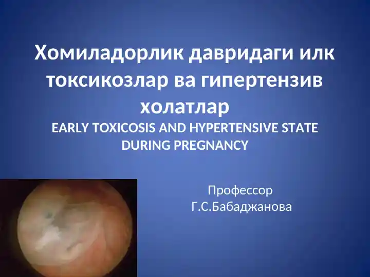 Хомиладорлик давридаги илк токсикозлар ва гипертензив холатлар (EARLY TOXICOSIS AND HYPERTENSIVE STATE DURING PREGNANCY)
