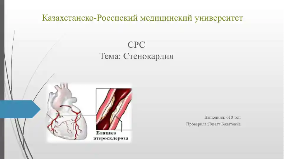 Стенокардия