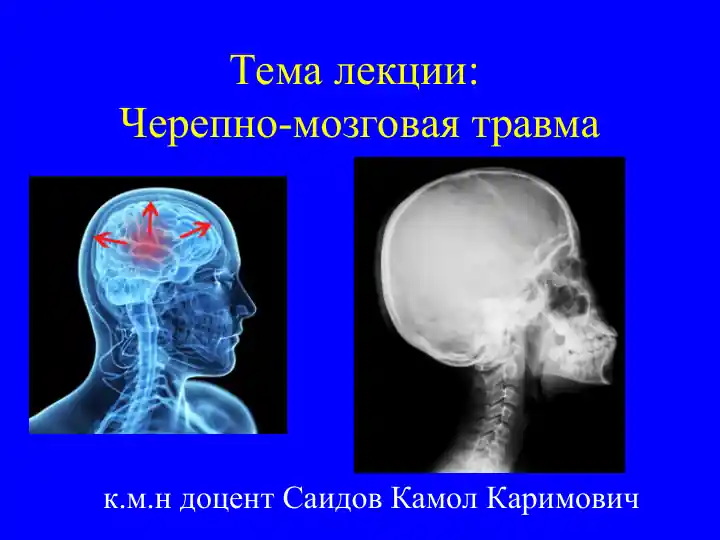 Черепно-мозговая травма