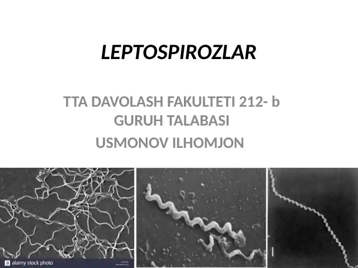 LEPTOSPIROZLAR