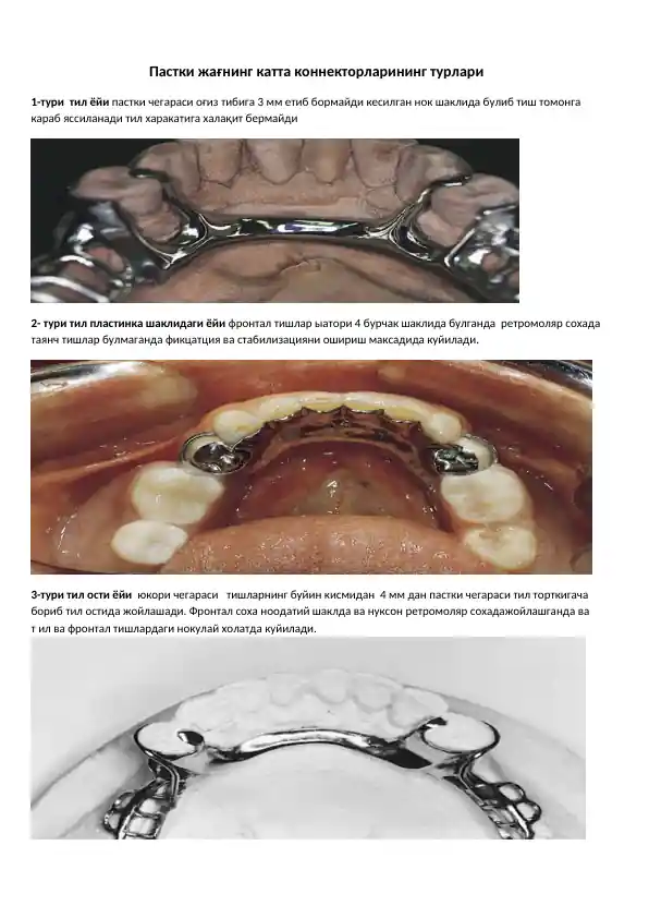Pastki jagnining katta konnektorlarining turlari