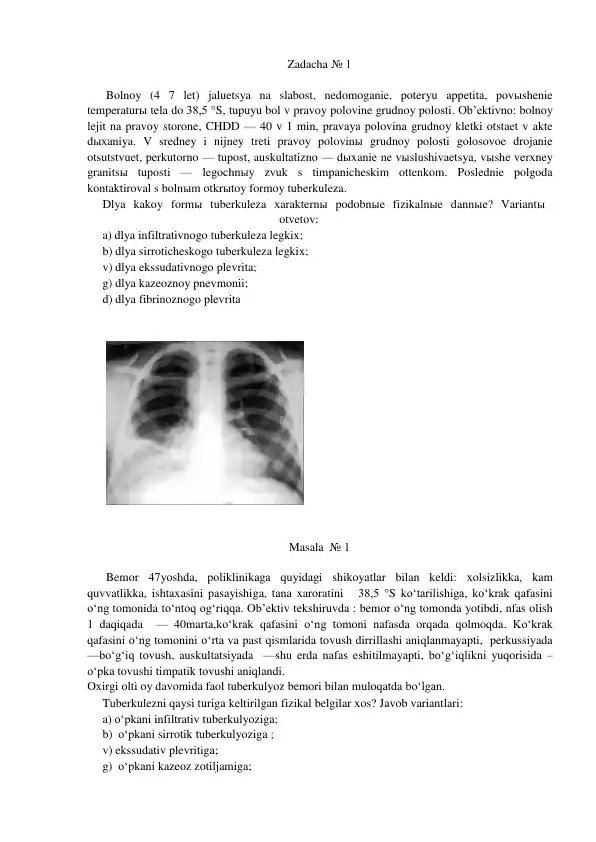 Tuberkulezga oid klinik fizikal ko‘rsatkichlar