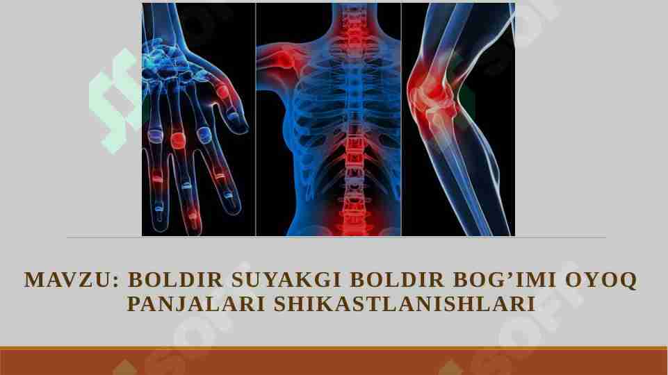 BOLDIR SUYAKGI BOLDIR BOG’IMI OYOQ PANJALARI SHIKASTLANISHLARI