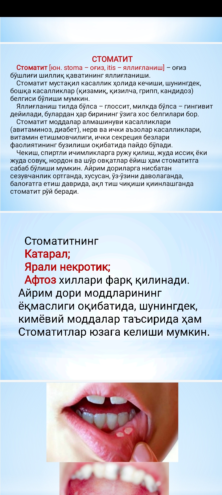 СТОМАТИТ. АНГИНА. ГАСТРИТ. ЯРА КАСАЛЛИГИ.АППЕНДИТЦИТ. ПАТОМОРФОЛОГИЯСИ