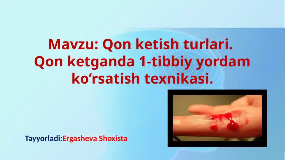 Qon ketish turlari. Qon ketganda 1-tibbiy yordam ko’rsatish texnikasi