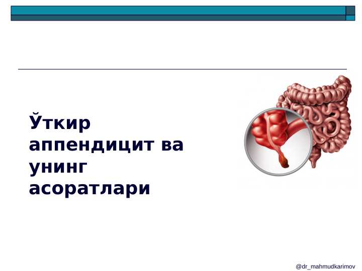 O'tkir apenditsit ppt