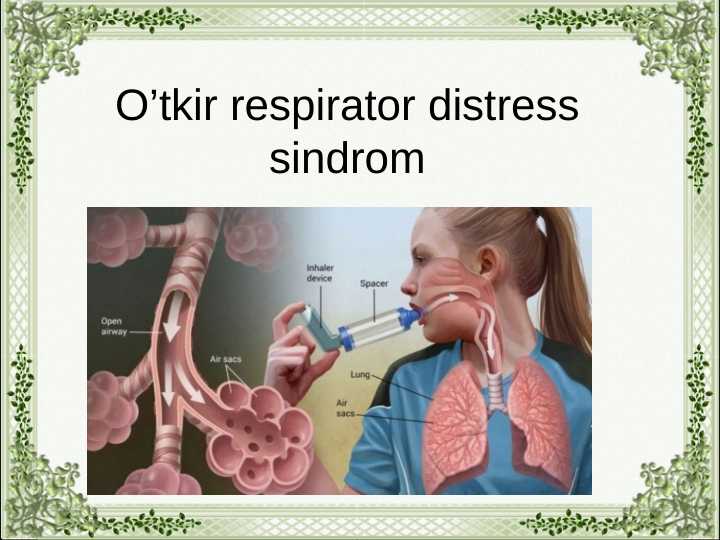 O’tkir respirator distress sindrom
